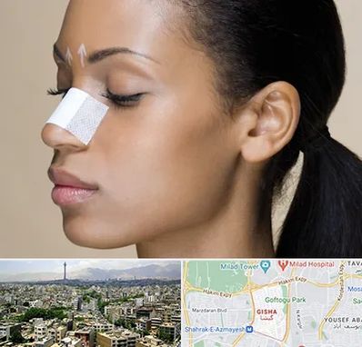 دکتر جراح بینی خانم در گیشا 