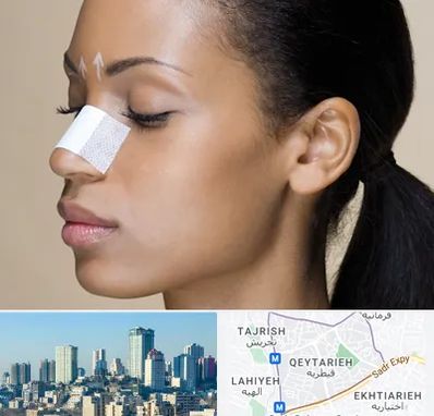 دکتر جراح بینی خانم در قیطریه 