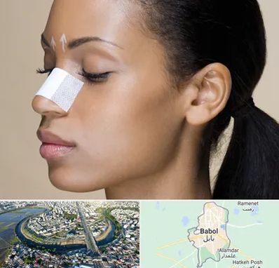 دکتر جراح بینی خانم در بابل