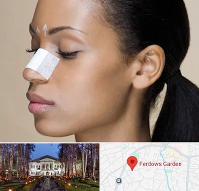 دکتر جراح بینی خانم در باغ فردوس