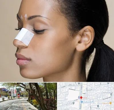 دکتر جراح بینی خانم در خیابان توحید اصفهان 