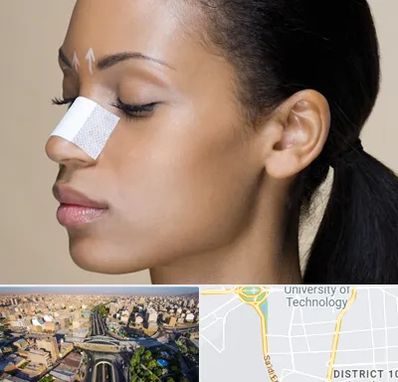 دکتر جراح بینی خانم در استاد معین 