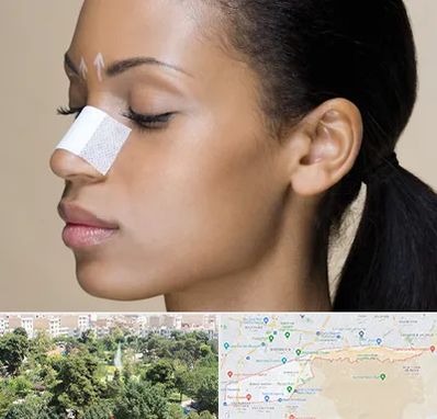 دکتر جراح بینی خانم در منطقه 13 تهران 