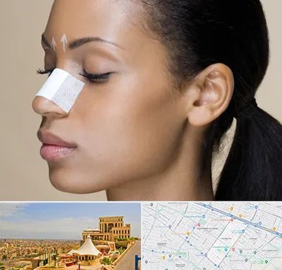 دکتر جراح بینی خانم در هاشمیه مشهد 