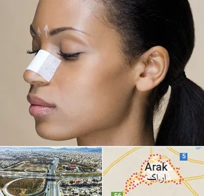 دکتر جراح بینی خانم در اراک