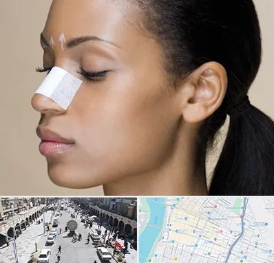 دکتر جراح بینی خانم در نادری اهواز 