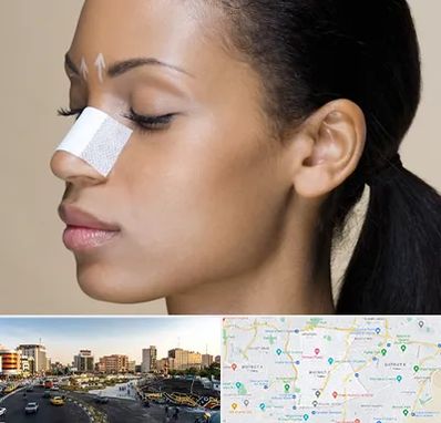 دکتر جراح بینی خانم در منطقه 7 تهران 