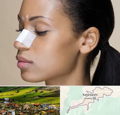 دکتر جراح بینی خانم در کلاردشت