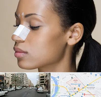 دکتر جراح بینی خانم در زیتون کارمندی اهواز 