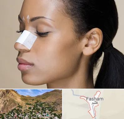 دکتر جراح بینی خانم در فشم