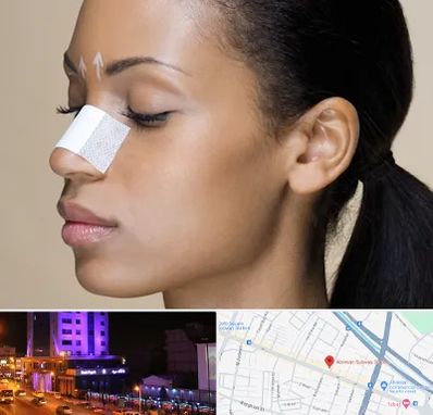 دکتر جراح بینی خانم در آبرسان تبریز