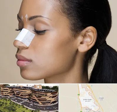 دکتر جراح بینی خانم در شاهین شهر