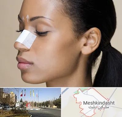 دکتر جراح بینی خانم در مشکین دشت