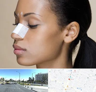 دکتر جراح بینی خانم در بلوار کلاهدوز مشهد 