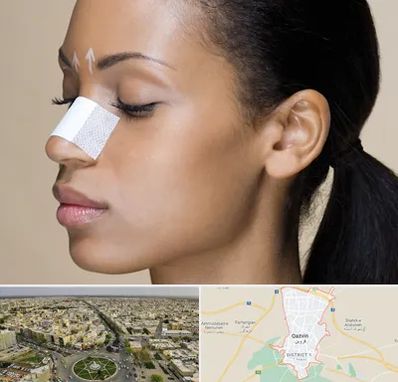 دکتر جراح بینی خانم در قزوین