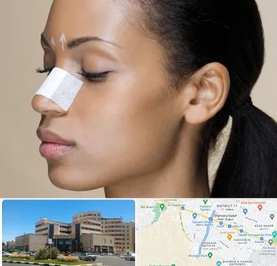 دکتر جراح بینی خانم در صیاد شیرازی مشهد 