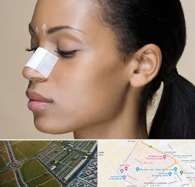 دکتر جراح بینی خانم در الهیه مشهد 