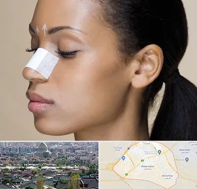 دکتر جراح بینی خانم در رباط کریم