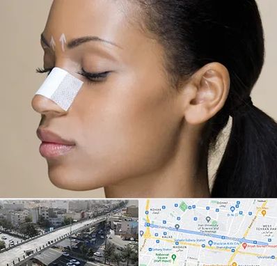 دکتر جراح بینی خانم در فرجام 