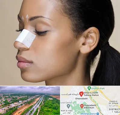 دکتر جراح بینی خانم در قصرالدشت شیراز 