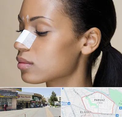 دکتر جراح بینی خانم در پرواز تبریز