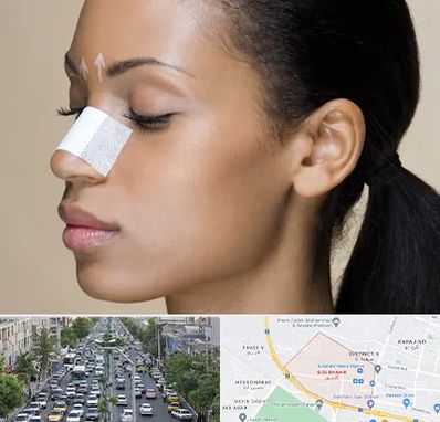 دکتر جراح بینی خانم در گلشهر کرج 