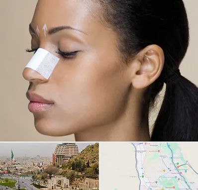 دکتر جراح بینی خانم در فرهنگ شهر شیراز 