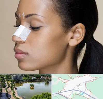 دکتر جراح بینی خانم در لنگرود