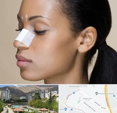 دکتر جراح بینی خانم در شهر زیبا 