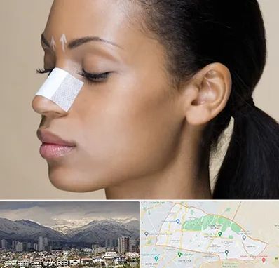 دکتر جراح بینی خانم در منطقه 4 تهران 