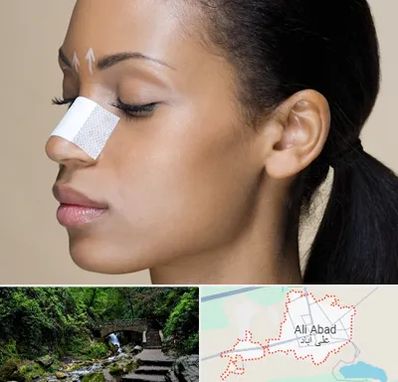 دکتر جراح بینی خانم در علی آباد کتول