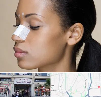 دکتر جراح بینی خانم در ایران زمین