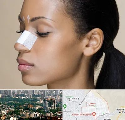 دکتر جراح بینی خانم در عظیمیه کرج 