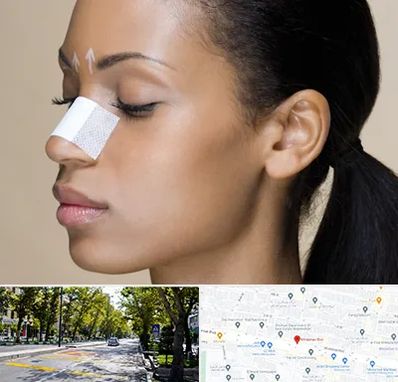 دکتر جراح بینی خانم در میرداماد 