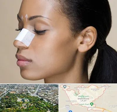 دکتر جراح بینی خانم در شهرکرد