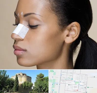 دکتر جراح بینی خانم در مرداویج اصفهان 