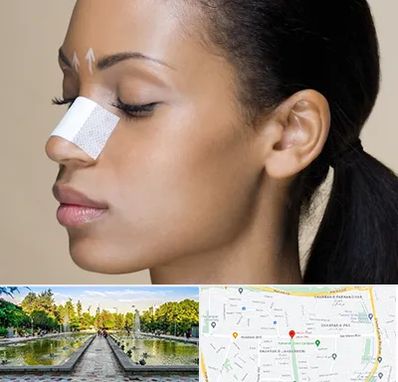 دکتر جراح بینی خانم در سرسبز 