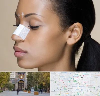 دکتر جراح بینی خانم در منطقه 12 تهران 