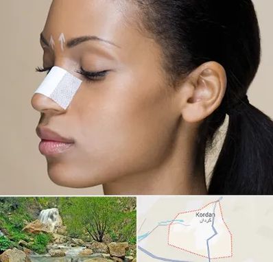 دکتر جراح بینی خانم در کردان