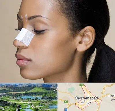 دکتر جراح بینی خانم در خرم آباد