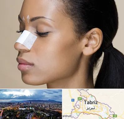 دکتر جراح بینی خانم در تبریز