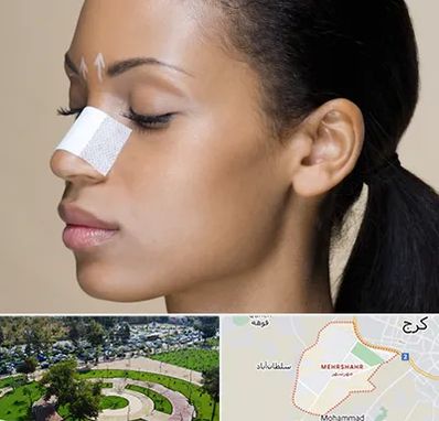 دکتر جراح بینی خانم در مهرشهر کرج 