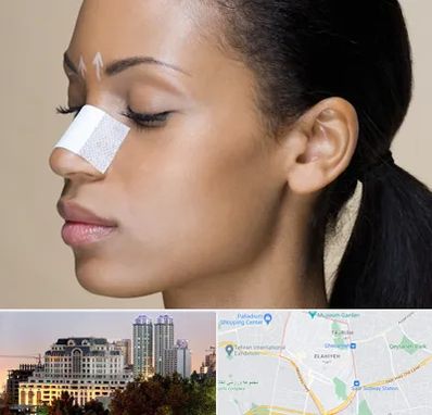 دکتر جراح بینی خانم در فرشته 