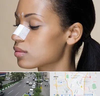 دکتر جراح بینی خانم در ستارخان 