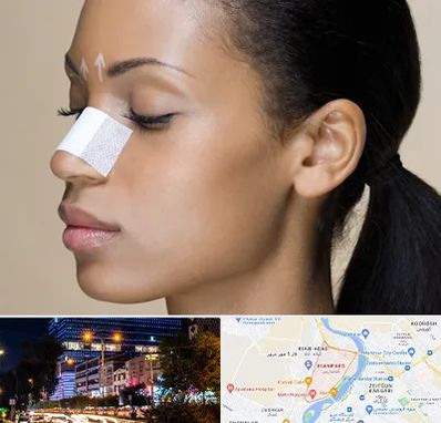 دکتر جراح بینی خانم در کیانپارس اهواز 