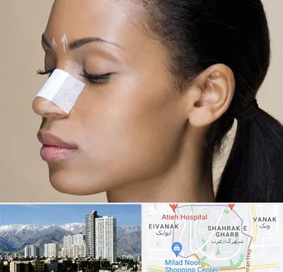 دکتر جراح بینی خانم در شهرک غرب 