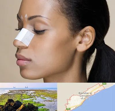 دکتر جراح بینی خانم در بندرلنگه