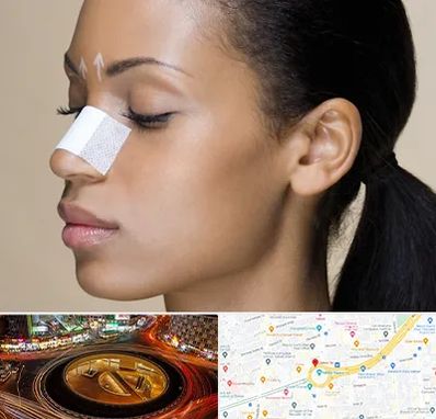 دکتر جراح بینی خانم در میدان ولیعصر 