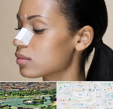 دکتر جراح بینی خانم در منطقه 9 تهران 