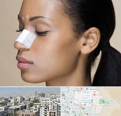 دکتر جراح بینی خانم در منطقه 14 تهران 